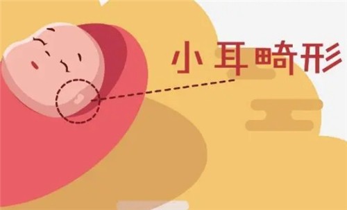 【河南中醫(yī)藥大學(xué)一附院】莊洪興教授暑假坐診，耳畸形修復(fù)限時(shí)預(yù)約！