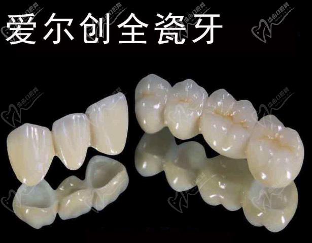 愛(ài)爾創(chuàng)和威蘭德全瓷牙有什么區(qū)別？
