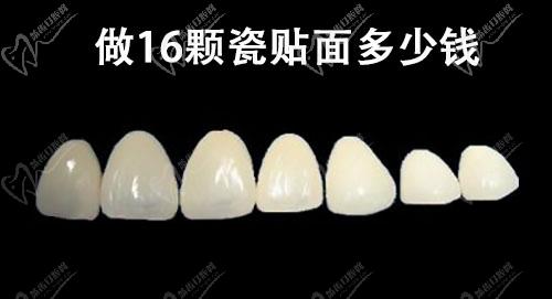 做16顆瓷貼面多少錢(qián)