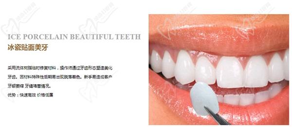 冰瓷牙和全瓷牙哪一個更好？看完冰瓷牙和全瓷牙的區(qū)別就明了