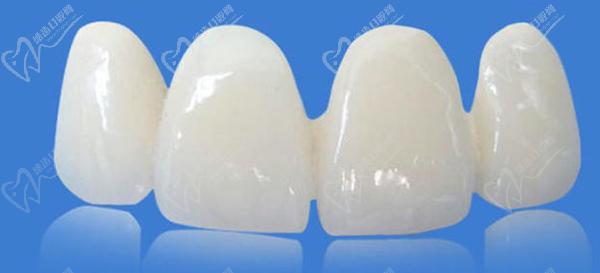 冰瓷牙和全瓷牙哪一個更好？看完冰瓷牙和全瓷牙的區(qū)別就明了