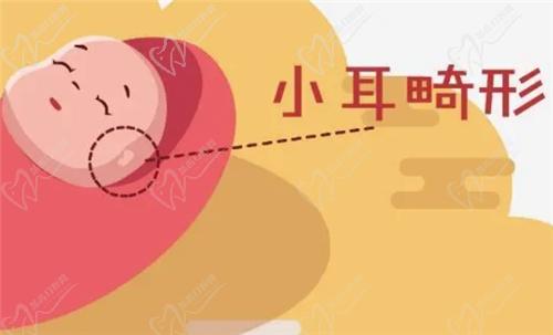 什么是耳畸形？哪些情況需要治療？